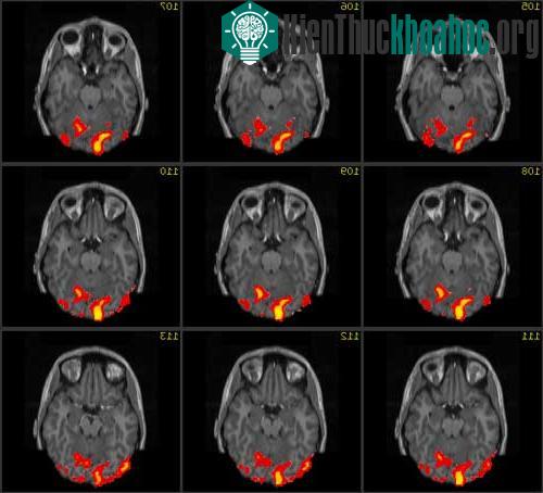 Phương pháp chụp cộng hưởng từ chức năng (fMRI) để quét não bộ.&nbsp;(Ảnh: fmrib)