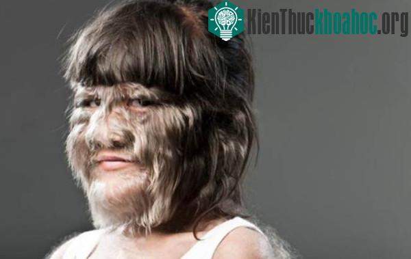 Cận cảnh khuôn mặt của Supatra Sasuphan.