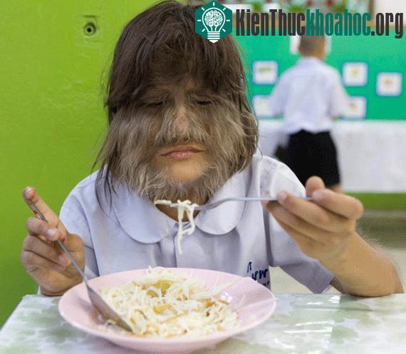 Supatra Sasuphan gặp khó khăn trong cuộc sống sinh hoạt hàng ngày.