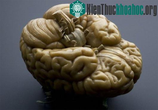 Điều gì sẽ xảy ra nếu "kích điện" vào bộ não chết