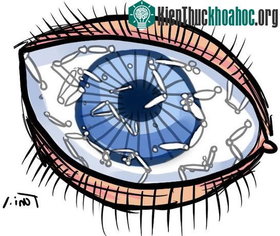 Lời giải khoa học cho hiện tượng "ruồi bay trước mắt"