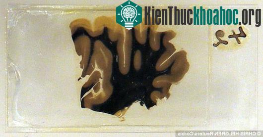 Phát hiện mới trái ngược về bộ não của Einstein