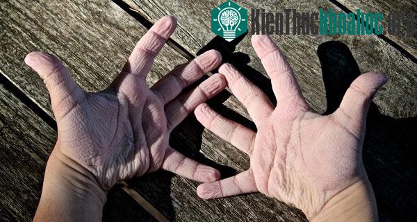 Các phản ứng cơ thể kỳ quặc khiến bạn khó hiểu