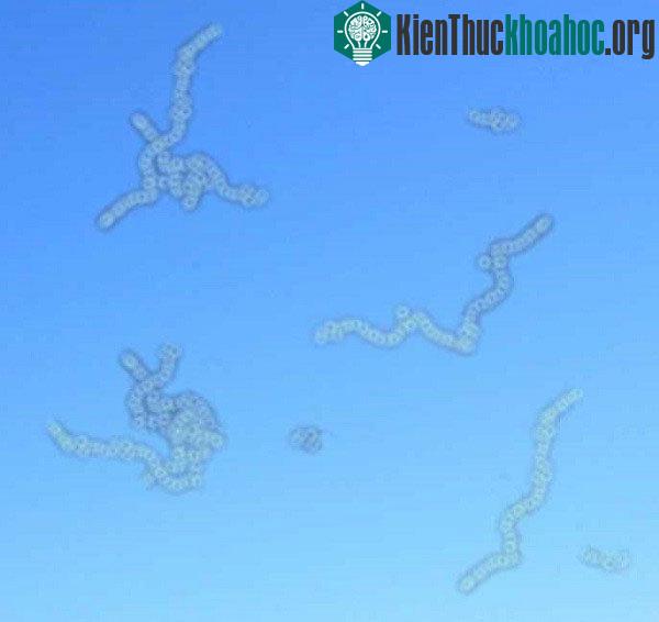 Người mắc bệnh sẽ thấy rõ những đốm nhỏ, vẩn đục hơn khi nhìn lên bầu trời quang đãng ban ngày.