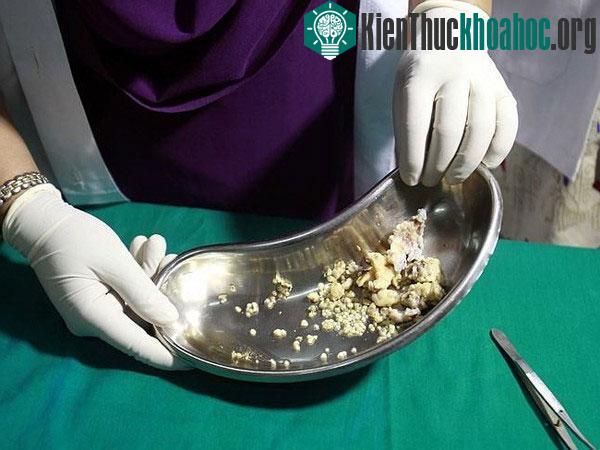Xem cách các chuyên gia nhận biết danh tính người chết