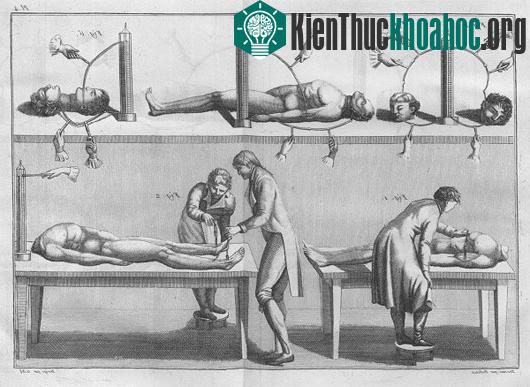 Điều gì sẽ xảy ra nếu "kích điện" vào bộ não chết