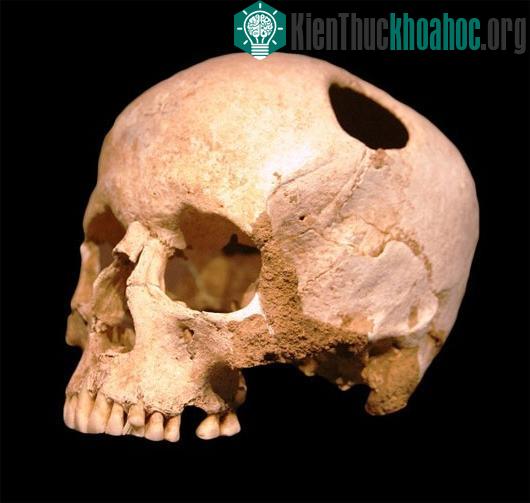 Các cách phẫu thuật "cắt ghép cơ thể" từ ghê rợn đến hiện đại