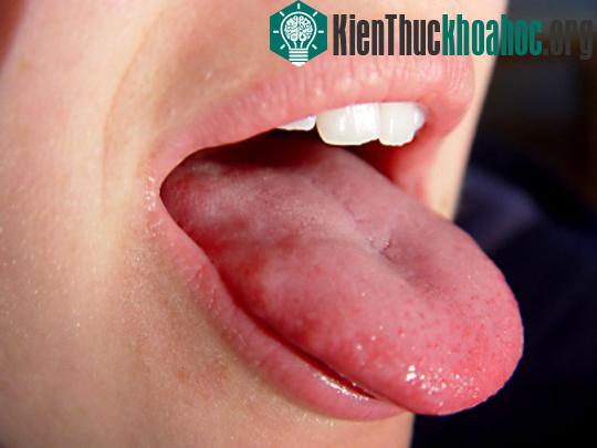 Lưỡi