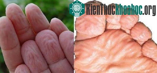 Sau 30 phút - 1 giờ đồng hồ, da ở lòng bàn tay, bàn chân bắt đầu trắng nhợt vì ngâm nước