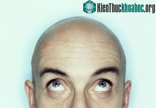 Đàn ông hói đầu được coi là mạnh mẽ hơn và có khả năng lãnh đạo tốt hơn những người đàn ông khác.