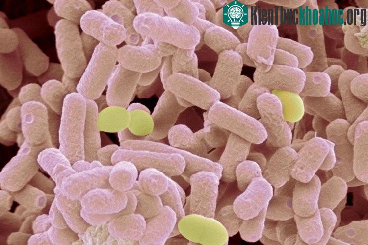Loại siêu khuẩn mới này có thể kháng lại cả carbapenems - nhóm kháng sinh mạnh nhất.