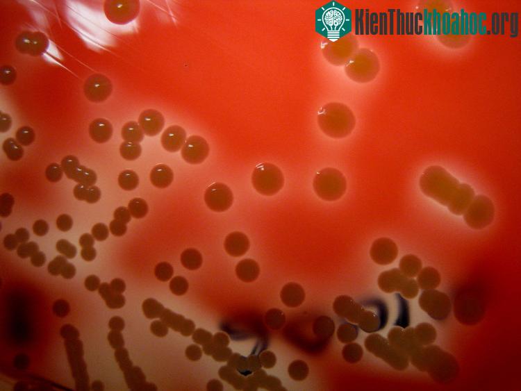 Chủng vi khuẩn mới Staphylococcus lugdunensis.