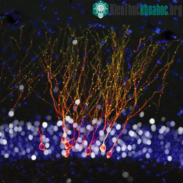Hình ảnh của chủng Retrovirus. (Nguồn: HNGN).