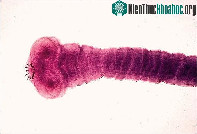 Các nang sán phát triển và ký sinh nhờ dinh dưỡng chúng ta ăn hàng ngày.