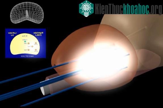 Công ty công nghệ sinh học STEBA Biotech ở Luxembourg đã tài trợ cho nghiên cứu sử dụng thuốc nhạy sáng và tia laser để tiêu diệt các khối u. (Ảnh đồ họa quá trình trị liệu: STEBA Biotech).