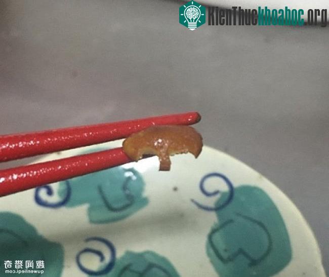 Món ăn kỳ lạ khiến cho chàng trai bị đau bụng và... lặn một hơi không sủi tăm.