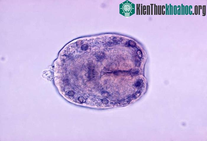 Sán kim E.granulosus chỉ dài 3-7mm, nhưng vô cùng nguy hiểm.