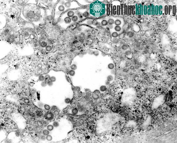 Virus gây sốt Rift Valley