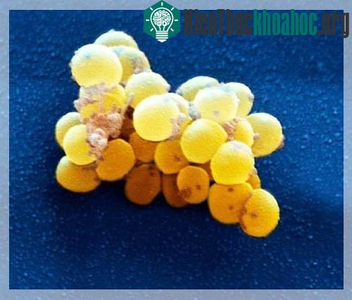 Vi khuẩn Staphlococcus epiderrmis