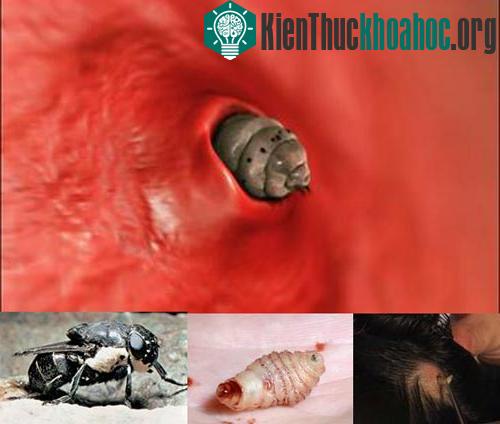 Những loài ký sinh kinh dị trên cơ thể người ảnh 0