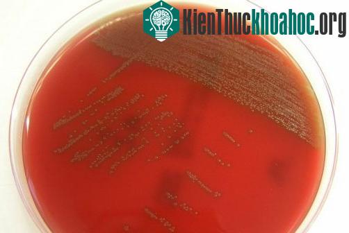 Vi khuẩn Streptococcus Tigurinus