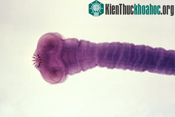 Các loài ký sinh trùng thích làm tổ và ăn não con người