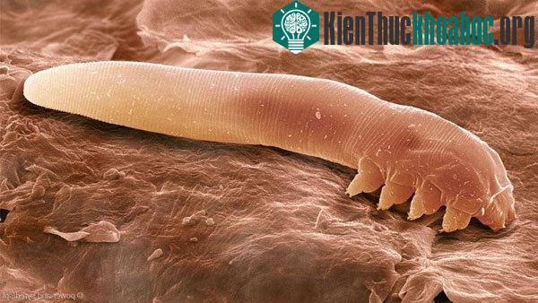 Ảnh loài Demodex folliculorum dưới kính hành vi điện tử quét (SEM)