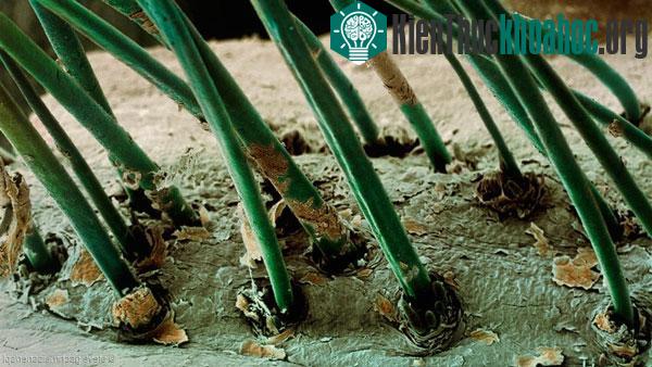 Demodex - Loài rận chuyên ký sinh trên... da mặt người