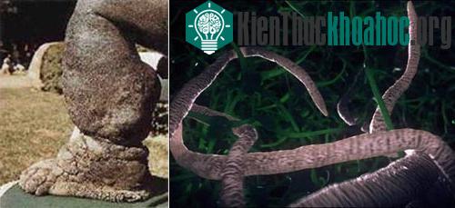 Những loài ký sinh kinh dị trên cơ thể người ảnh 4