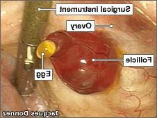 Lần đầu tiên ghi được hình ảnh trứng rụng ảnh 0