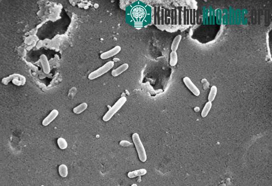 Ảnh minh họa vi khuẩn Pseudomonas.