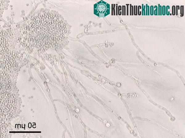 Quá trình sinh sản của men không có gen giao phối ảnh 0