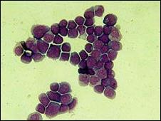 Tìm ra bản đồ gene của bệnh ung thư ảnh 0