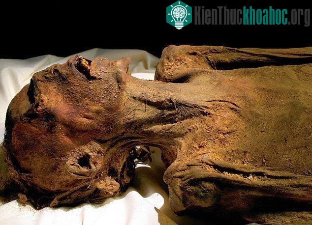 "Xác ướp la hét" với nét mặt đậm vẻ kinh hoàng. (Ảnh: Ancient Origins).