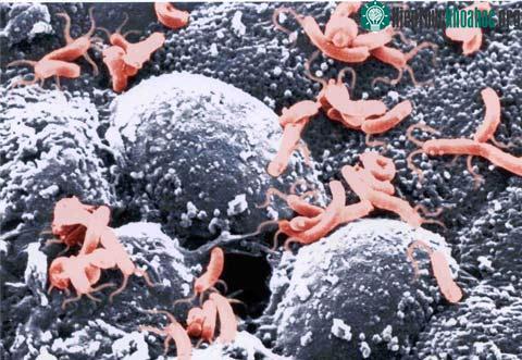 Vi khuẩn Helicobacter pylori (viết tắt là H. Pylori)