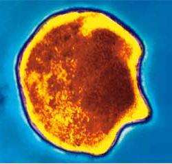 Vi khuẩn Chlamydia pneumoniae tấn công và lưu truyền trong con người qua ho, và hắt hơi
