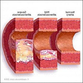 Giải Nobel y sinh học năm 2005 - Một cõi đi về với vi khuẩn ảnh 6
