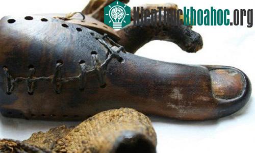 Bộ phận giả&nbsp;lâu đời nhất có niên đại 3.000 năm tuổi. Những người khiếm khuyết ở Ai Cập cổ đại đã sử dụng chân tay giả để có thể đi lại bình thường. Chúng thường được làm từ gỗ giúp cho đôi châ...