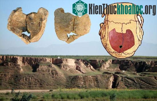 Chính việc quan hệ loạn luân đã khiến những lỗ hổng trên hộp sọ không được lấp đầy.