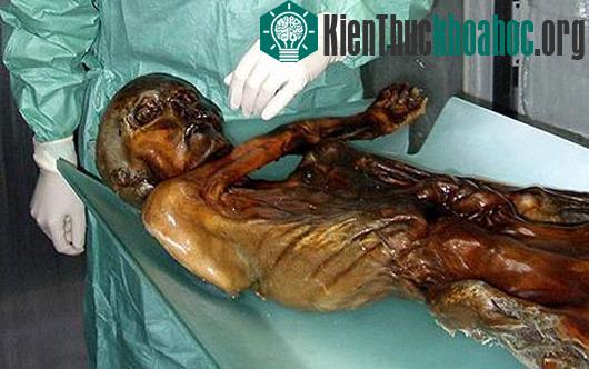 Xác ướp người băng Otzi.