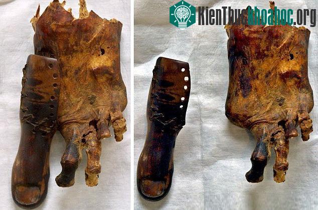 Ngón chân cái giả được chứng minh hỗ trợ việc đi lại của người mang