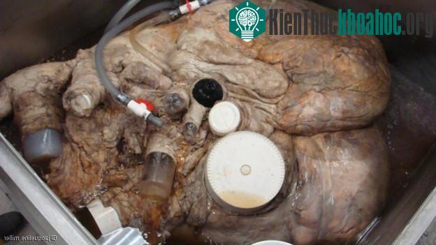 Cận cảnh trái tim "khủng" nhất thế giới của cá voi xanh
