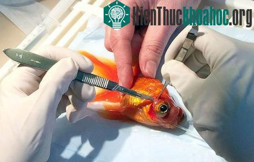 Ca phẫu thuật diễn ra thành công sau 45 phút. (Ảnh: SWNS)