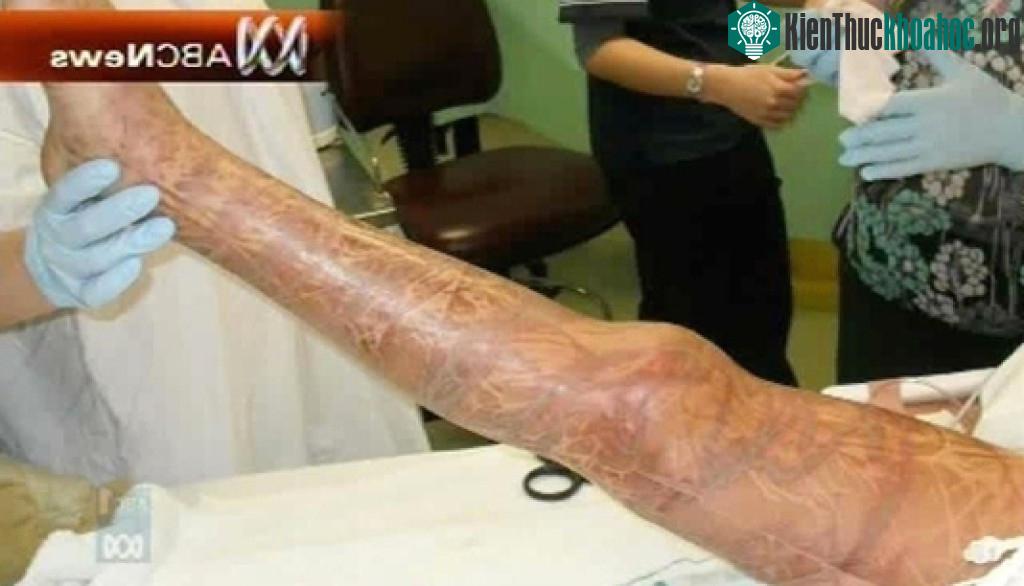 Các súc tu của loài sứa này có lượng lớn cnidocyte, khiến bạn bị nhiễm độc cực kỳ nguy hiểm.