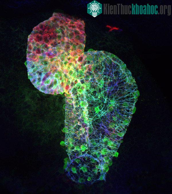 Tim cá ngựa vằn (zebrafish) tự nhân đôi khi gặp tổn thương