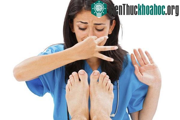 Những động vật bốc mùi nhất thế giới