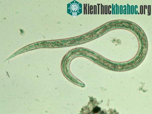 Giun móc. (Ảnh: cdc.gov)