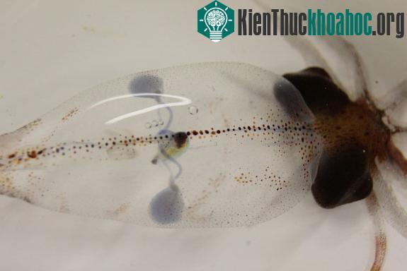 Hãy thử tưởng tượng nếu con người có ba tim thì sẽ sống được bao nhiêu năm nhỉ?