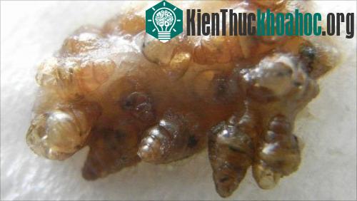 Khả năng kỳ lạ của ốc sên