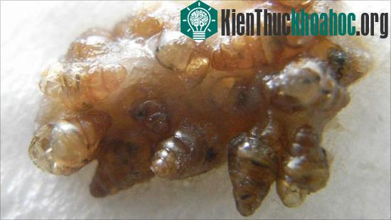 Bí quyết sinh tồn của ốc sên Nhật